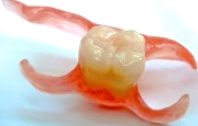 нейлоновый протез зуба