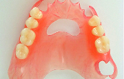 нейлоновый протез зуба